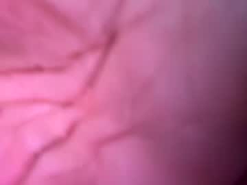 noaalbis